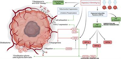 Targeting Immunometabolism in Glioblastoma